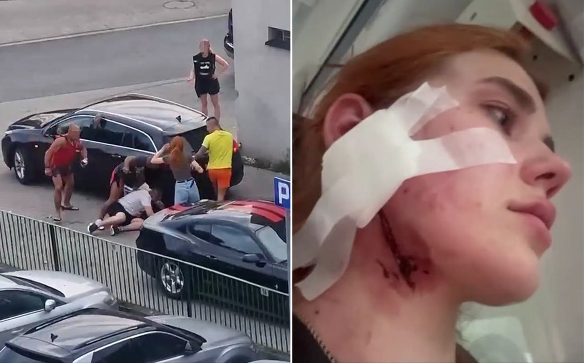 LaylahLilithah's tweet photo. Na wrocławskim Zakrzowie pobito  Nastię i Maksyma, w niedzielę (26 lipca). Polska #chujsaria, klapki, skarpetki i mięsnie zamiast mozgu.

Nikt z przechodniów nie interweniował. Sprawców nadal nie ujęto. https://t.co/nj5gPgKFvJ