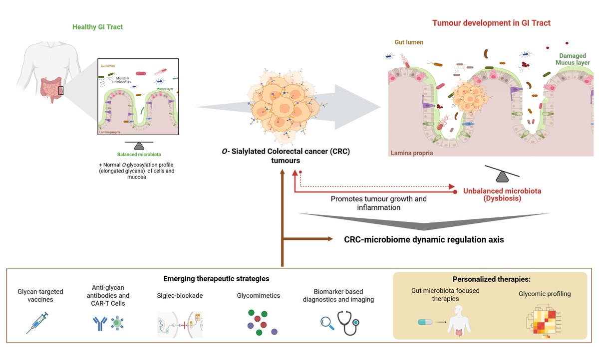 OAE_JCMT's tweet photo. How do cancer-associated O-glycans shape the colorectal cancer microenvironment? What role does the microbiome play in tumor progression and immune evasion?

📖 Read now: https://t.co/uqeaPvpkC6

#ColorectalCancer #CancerResearch #Glycobiolog #TumorMicroenvironment #Immunology https://t.co/LMqse0GTAx
