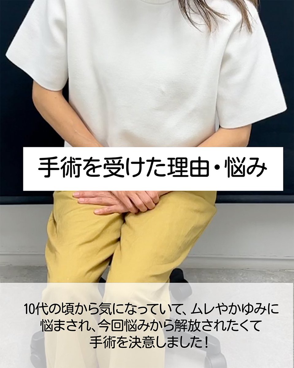 sbc_tada's tweet photo. 長年、ムレやかゆみに悩まされ手術を決意🔥
ダウンタイム経過レポ最後までご覧ください。

SBC池袋西口院 院長の多田彩子です。
施術が気になる方は、ぜひ最後までご覧ください!! https://t.co/zdeqvVTI5D