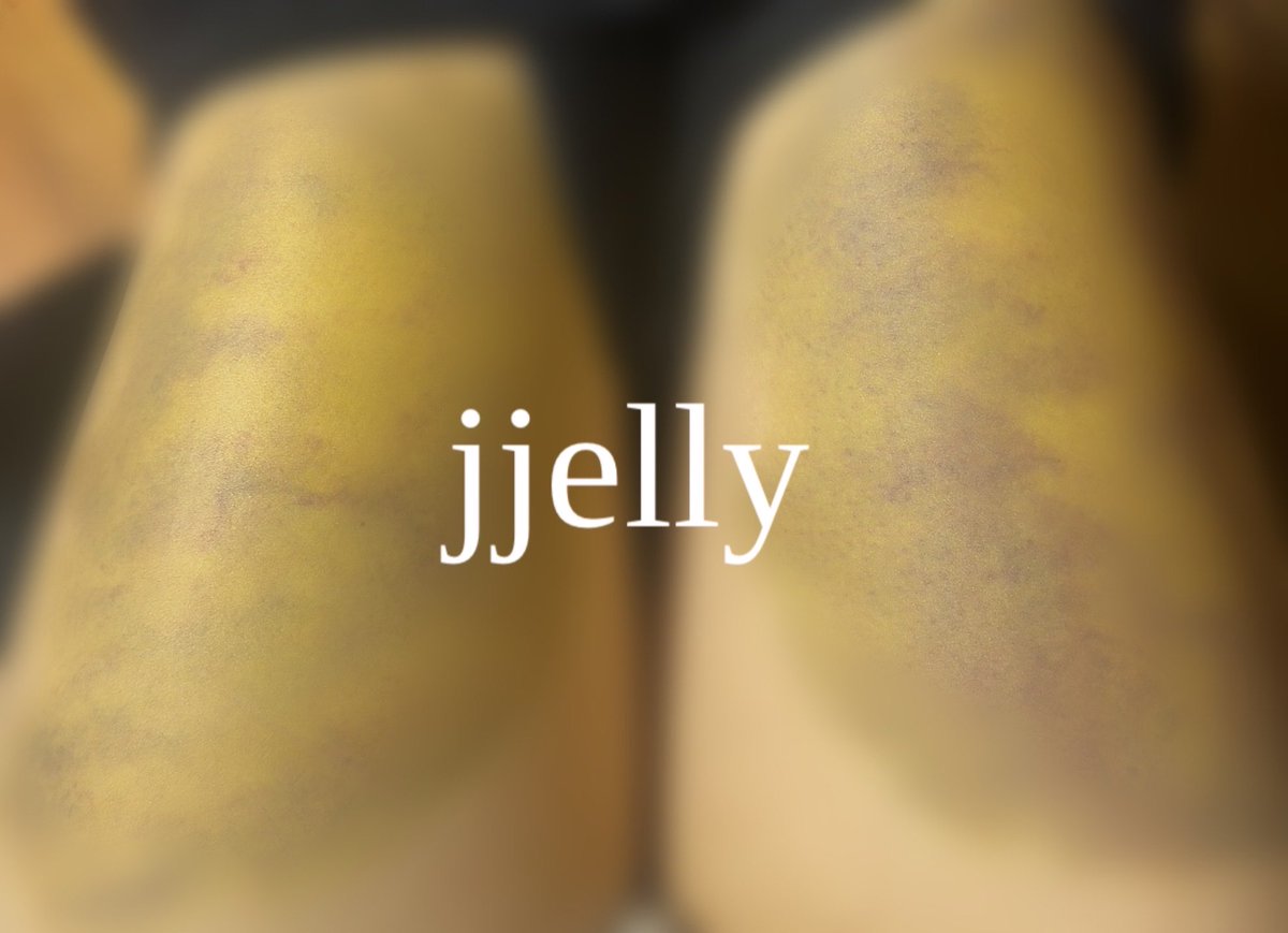 F_jjelly_S's tweet photo. 저때 레전드 아팠기.. 겨울에만 가능한 앞벅지,,���제 날 맴매 할 수 있는 건 아직 없지만🥲 
앞으로 만날 주인 뿐 https://t.co/00sCazGfCA