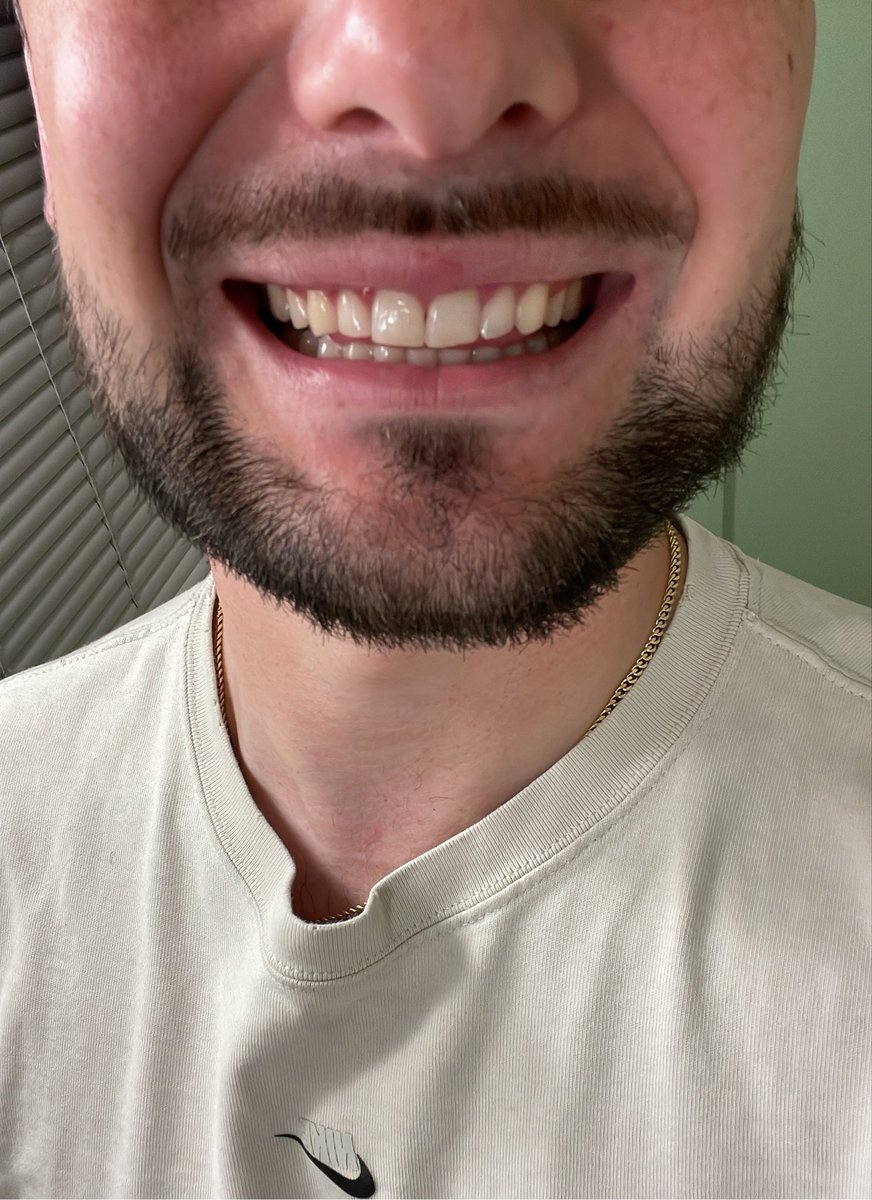 GenericMystery's tweet photo. @seacrettea_ I wish I had nicer teeth https://t.co/s1jNuM0XLs