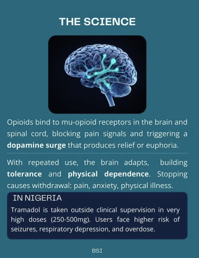 Bsinigeria1's tweet photo. The science behind opioids
#BSI https://t.co/2fZiIQvZoR