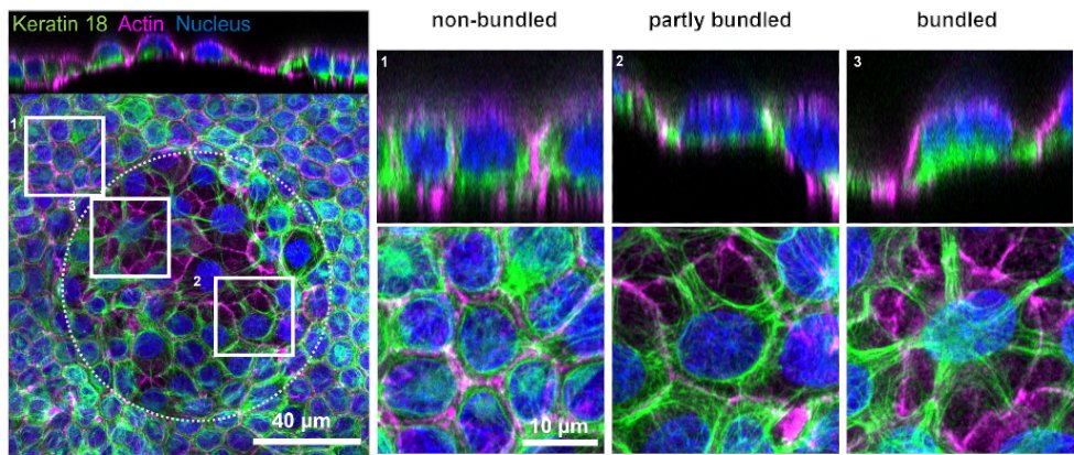 IBECBarcelona's tweet photo. How do tissues adapt to prolonged stretching?
#IBEC led study reveals that epithelial cells reorganise their keratin into supracellular networks, triggering "nuclear uncaging", a newly identified mechanism for adapting to mechanical stress.
Read more 👉 https://t.co/zndIO38rHG https://t.co/t0FeCd8S89