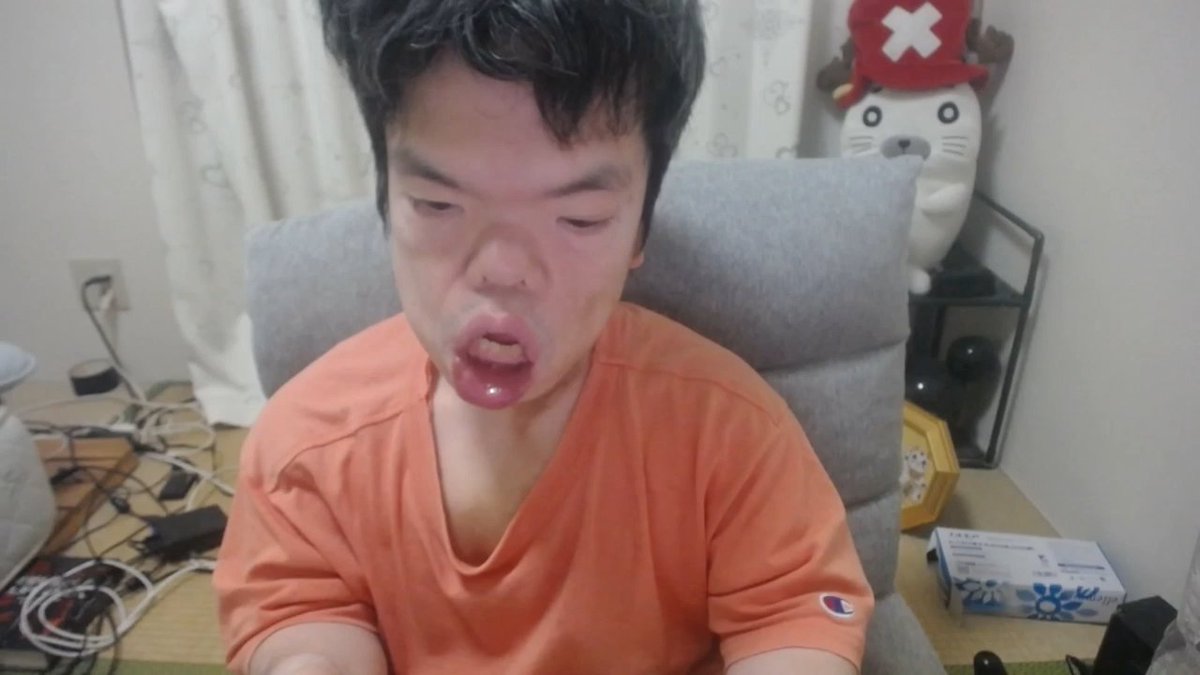 RootRotg2755's tweet photo. ぽんちゃん   以前から痒みを訴えていた原因　ダニだった    
主な感染経路は肌と肌の長時間にわたる直接接触や、寝具・衣類の共有    

現在は特効薬を貰い、早ければ1か月程度で治るとのこと  「ヒゼンダニ」 https://t.co/HH6WtIpxdh https://t.co/DkopLtZpVl