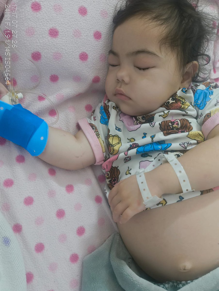 CelesteKidneys's tweet photo. Update on Celeste’s condition.

First of all, thank you to all of you who have donated towards her ongoing treatment.

It really helped her get through these last few months, and she’s going to make it to her third birthday in the first week of August.

She’s currently in hospital for the fifth time since her first hospitalisation, and we’re hoping that we will have her out in time for her third birthday.

She reached her largest weight since being diagnosed with kidney disease and was over 19 kg at one point (5.5 kg over her natural weight). Her vascularity was so depleted that they struggled to insert the IVs, as they couldn’t find her veins.

Her blood pressure is consistently elevated and they want to put her on ACE inhibitors, aspirin and other drugs which is concerning for me.

A simple cough and sore throat triggered her relapse this time.

She’s now been given steroid-sparing medication to treat her relapses at home, which can prevent complications from long-term steroid use that she has unfortunately suffered from.

We hope they work better than the steroids, as she’s become resistant to them and they no longer trigger her into remission.

We've tried natural remedies and none have worked so far.

The next phase is an invasive kidney biopsy to rule out any more sinister conditions, as her persistent haematuria and high blood pressure are causing concern for the consultant paediatric nephrologist and other doctors.

We’ve spoken at length to other parents with children suffering from this condition, and especially to parents who have a six-year-old who is currently experiencing a nephrotic episode after being diagnosed at four years old.

It’s a stark reminder of the length of this condition, which is why I must be persistent in sourcing help for her in any way I can.

Again, I thank everyone who has contributed to her ongoing care. I have made this social media page for her so that it stays relevant, so give this account a follow.

Her fundraiser is linked in the thread 👇🏻 

With more details about her condition.

I would appreciate it if people would continue to share any updates for her over the coming months and years.

Kind regards,  

Rob (Dad) and Celeste.