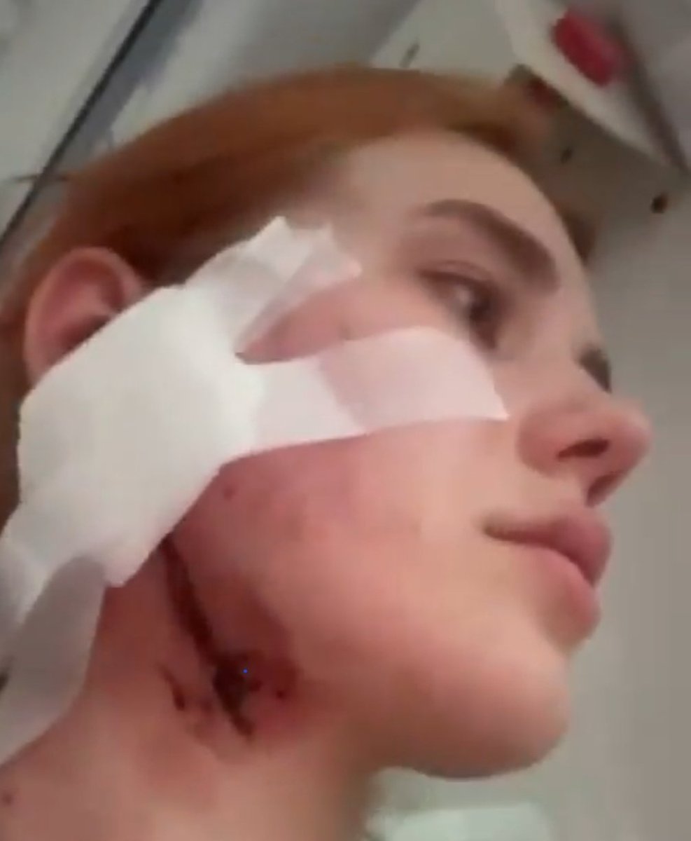 KrzysiekWSK's tweet photo. Kat i ofiara.
Adam C ps Cycu zawodnik Gromdy
Bezbronna młoda Ukrainka.

Politycy szczują
Bandyci biją
Dziennikarze bagatelizują

A mamy najfajnieszych i najbardziej pracowitych cudzoziemców jakich można mieć. https://t.co/jLjAUEHpHh