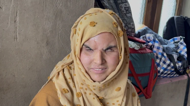ndtv's tweet photo. Blinded At 14, Woman Recalls J&amp;K "Pellet Gun Horror" After Delhi Protest
https://t.co/LUiWORyBQe https://t.co/01hOjFsgMa