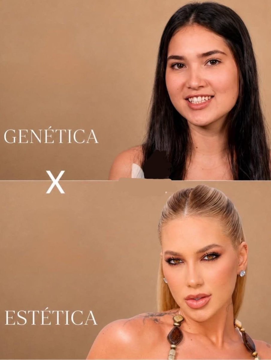 mbafraaude's tweet photo. Es la mejor cirugía estética que he visto en mi vida eh https://t.co/ilzMZgKv6p