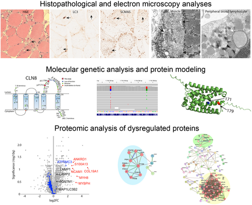 brainpathol's tweet photo. A novel myopathy with autophagic vacuoles associated with biallelic variants in CLN8
https://t.co/gHvek3M2ht https://t.co/AzsYrj563B