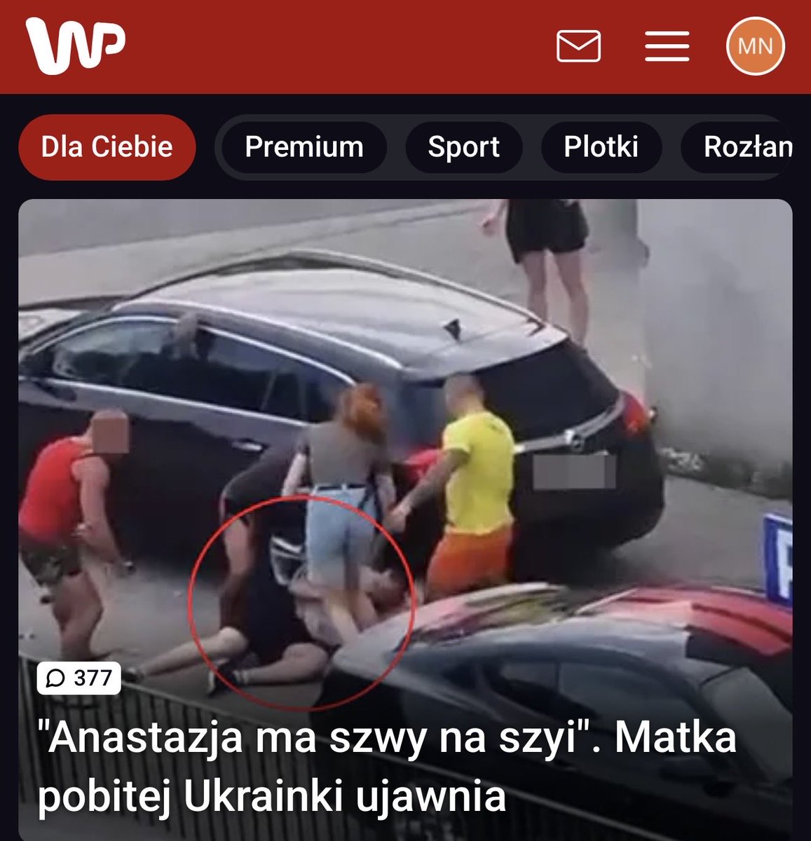 MarcinNajman's tweet photo. Nie dość że we trzech na jednego, to jeszcze jeden musiał mieć kastet, skoro tak poważnie skaleczył dziewczynę próbującą bronić chłopaka.
    To jest tak niegodne, tak niehonorowe, że brak słów.
   I te śmiecie mają czelność na tych nagrywkach promujących galę mówić o zasadach i że to charakterni ludzie🤦‍♂️
   Do młodych, to nie ma nic wspólnego z odwagą, wręcz przeciwnie, to tchórzostwo w czystej postaci. Odwagę pokazała w tej sytuacji tylko ta dziewczyna.
    Nie słuchajcie tych zwyroli na tych pseudo charakternych nagraniach. 
   Odwaga to stawiać czoła niebezpieczeństwu. 
    Oni atakują w trzech, być pewnym, że nic im nie grozi. Taka to „odwaga”.