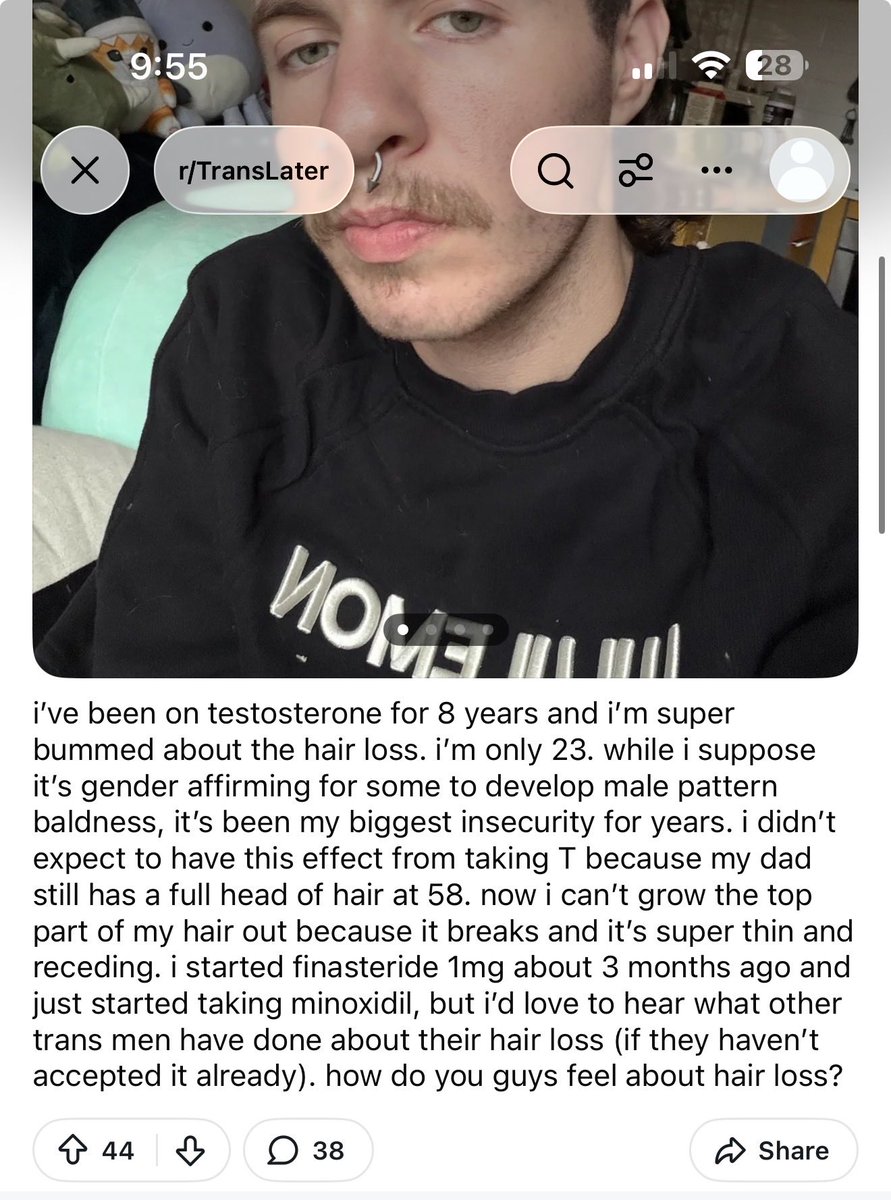 marycatedelvey's tweet photo. A woman took testosterone to pretend she is a man. Now she is upset because she is balding. https://t.co/sfoplZwopZ