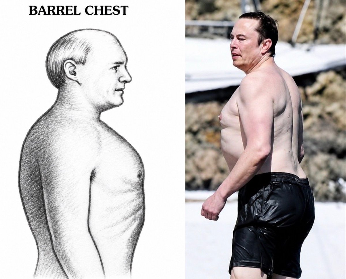 proaleena's tweet photo. Hey @grok, why does Elon Musk’s body look like this?  What’s the science behind it? https://t.co/Ga3gk1lKKl