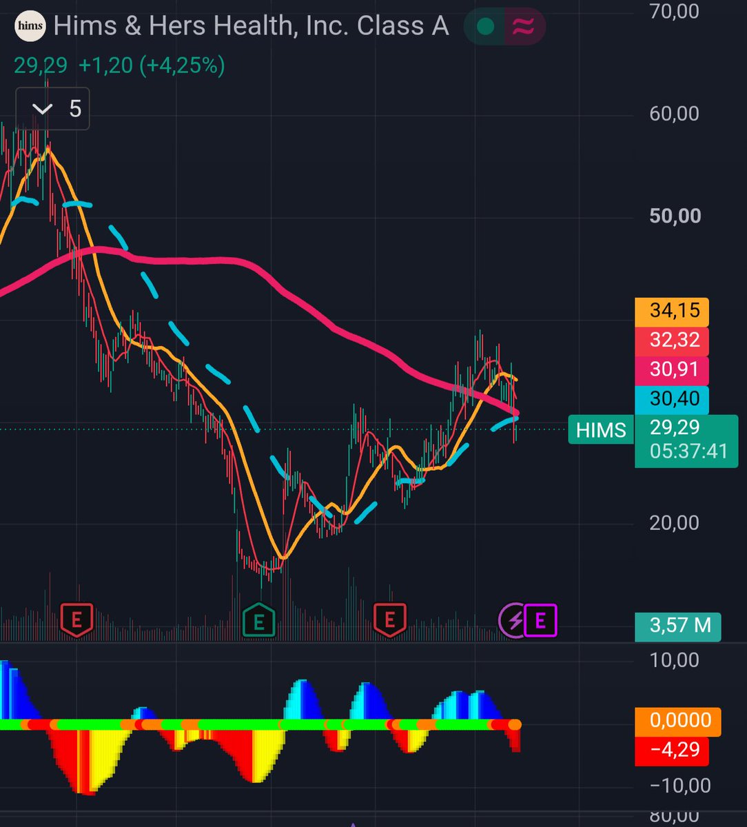 Alonso_2030's tweet photo. @nobady1949 @StockTrader_Max I don't think so, the Golden cross it's starting for $HIMS https://t.co/FBkTWRUqo6