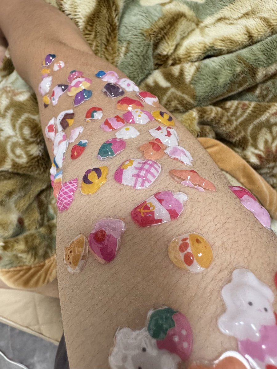 chibikko326's tweet photo. 私の太い腕を晒してすいません。
末っ子怪獣にこんな目に😭 https://t.co/WieBjtp8FH