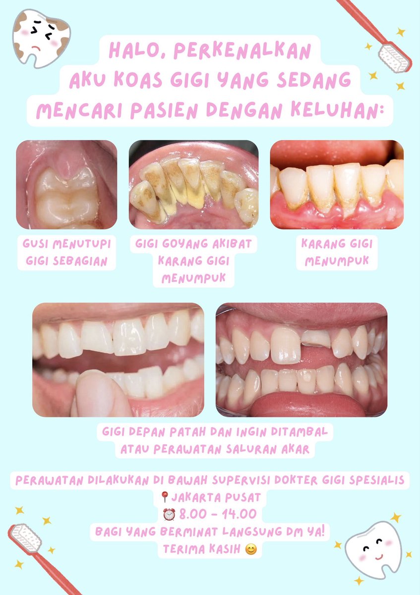 toothxoxo's tweet photo. haii, bagi yang punya keluhan karang gigi, gigi tertutup gusi, gigi patah yang ingin ditambal, dan mau dirawat oleh koas gigi boleh dm aku ya, thank you!

#koasgigi #zonauang #wtb #wts #gigipatah #tambalgigi #scaling #karanggigi #jakartapusat #gigigoyang https://t.co/V9pEb3GShw