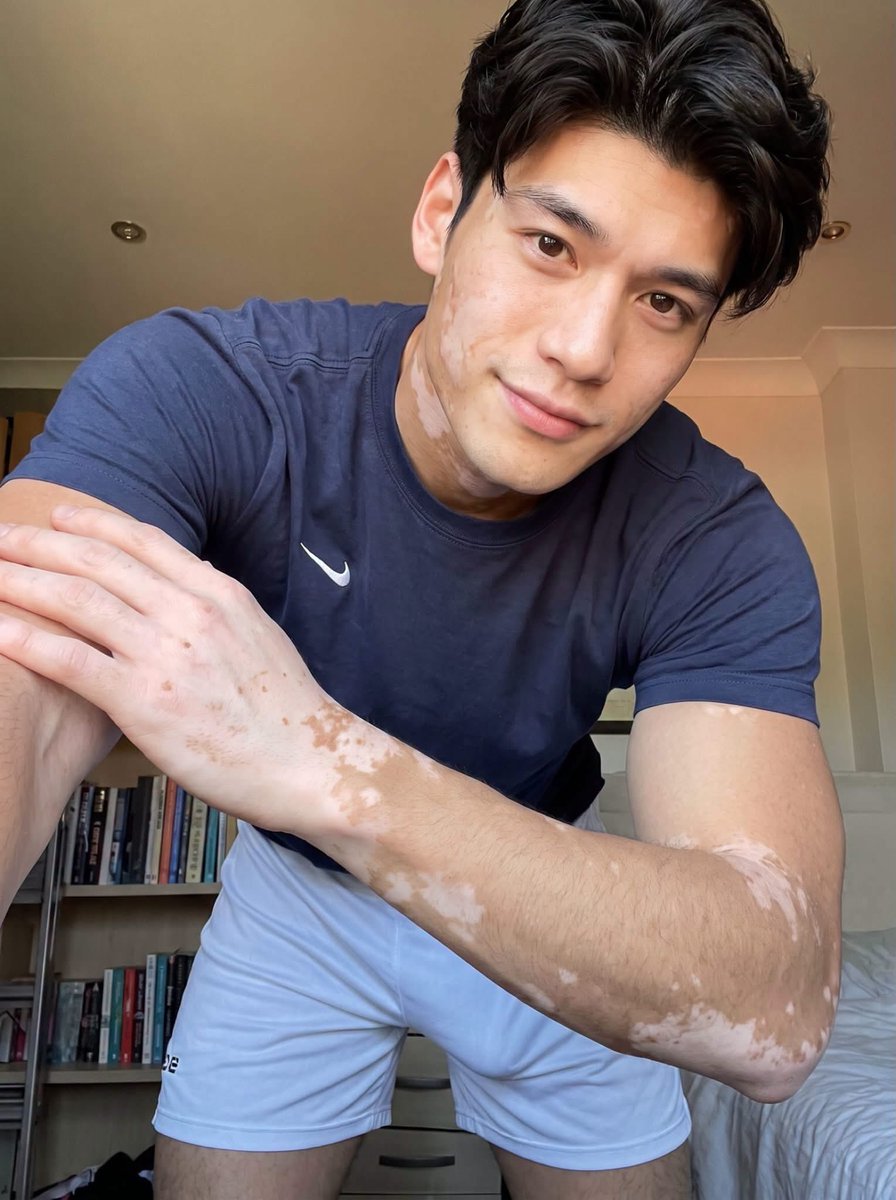 SPjorse's tweet photo. เขาเป็น โรค อะไร แล้ว จะมีโอกาส รักษาหายไหม  เคยเห็น หลายคน เหมือนกันนะ แบบนี้ https://t.co/ca45sh8svj