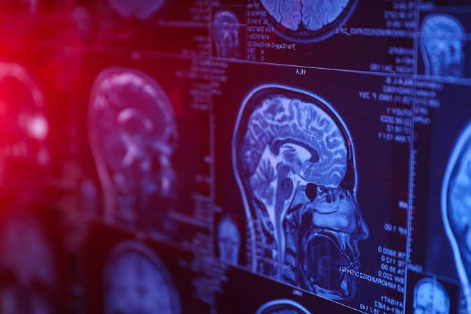 NightSkyToday's tweet photo. JUST IN🚨: Scientists Suggest that Nerve Fibers in Brain may be Capable of Generating Quantum Entanglement. https://t.co/12N7LKNT0r