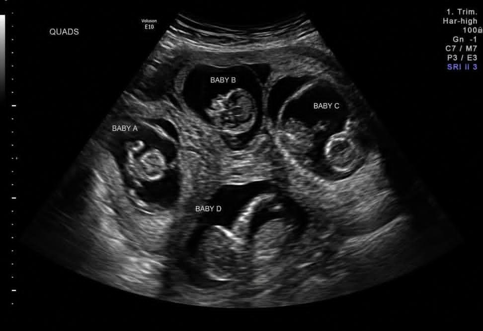 imanq56q's tweet photo. You go to the doctor cause yo stomach been hurting, the doctor does an ultrasound and you see this. What’s next? https://t.co/PlBJfjpWQq