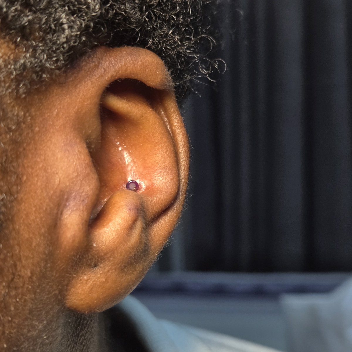 imose_ng's tweet photo. Conch 
Done with a glass retainer https://t.co/JzX9hFom93