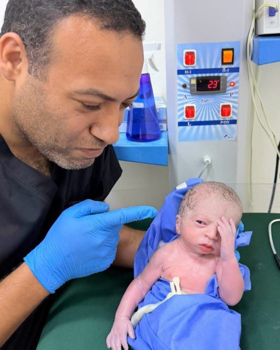 gagahaberyeni's tweet photo. Bir doktor, yeni doğan bebeğin tepkisini paylaştı. https://t.co/F3uOlo63qa