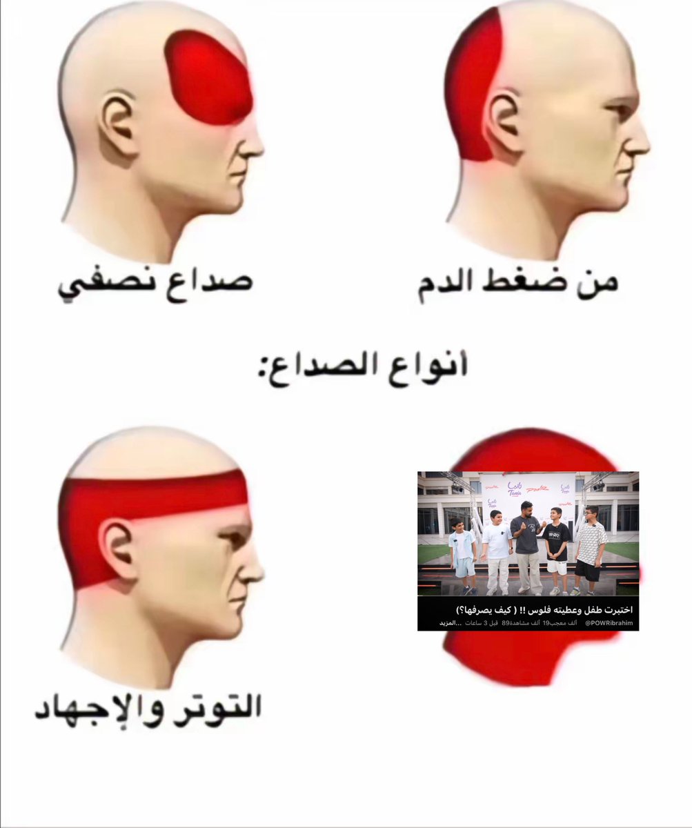 _yove1's tweet photo. 🔴 تحذير خذوا لكم حبة بندول قبل المقطع😂🔴 https://t.co/tI4qr05KLw
