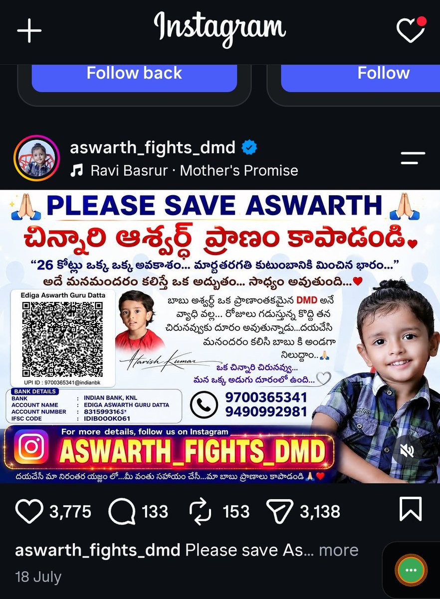 chai_seccc's tweet photo. @SonuSood @SoodFoundation Sonu Sir, this boy is suffering from SMA type disease, costs 26 crores. Pls do the needful. https://t.co/CaPGE8Q7gb