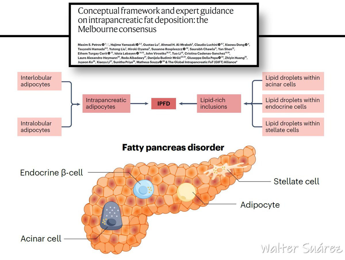 a_fisiolog57853's tweet photo. Consenso que establece un marco conceptual integral y guía sobre la acumulación de grasa intrapancreática y los desórdenes que la acompañan.

¡¡¡A leer, zagales!!!

Link en mi bio

o

https://t.co/w96Cn3SaZ2 https://t.co/oFENUVcbwe