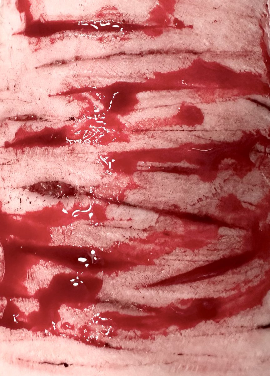 autopsiedangel's tweet photo. Old fake sfx its MAKEUP its fake its not real its sfx hi guys #slittwt https://t.co/8mPwgylHYu