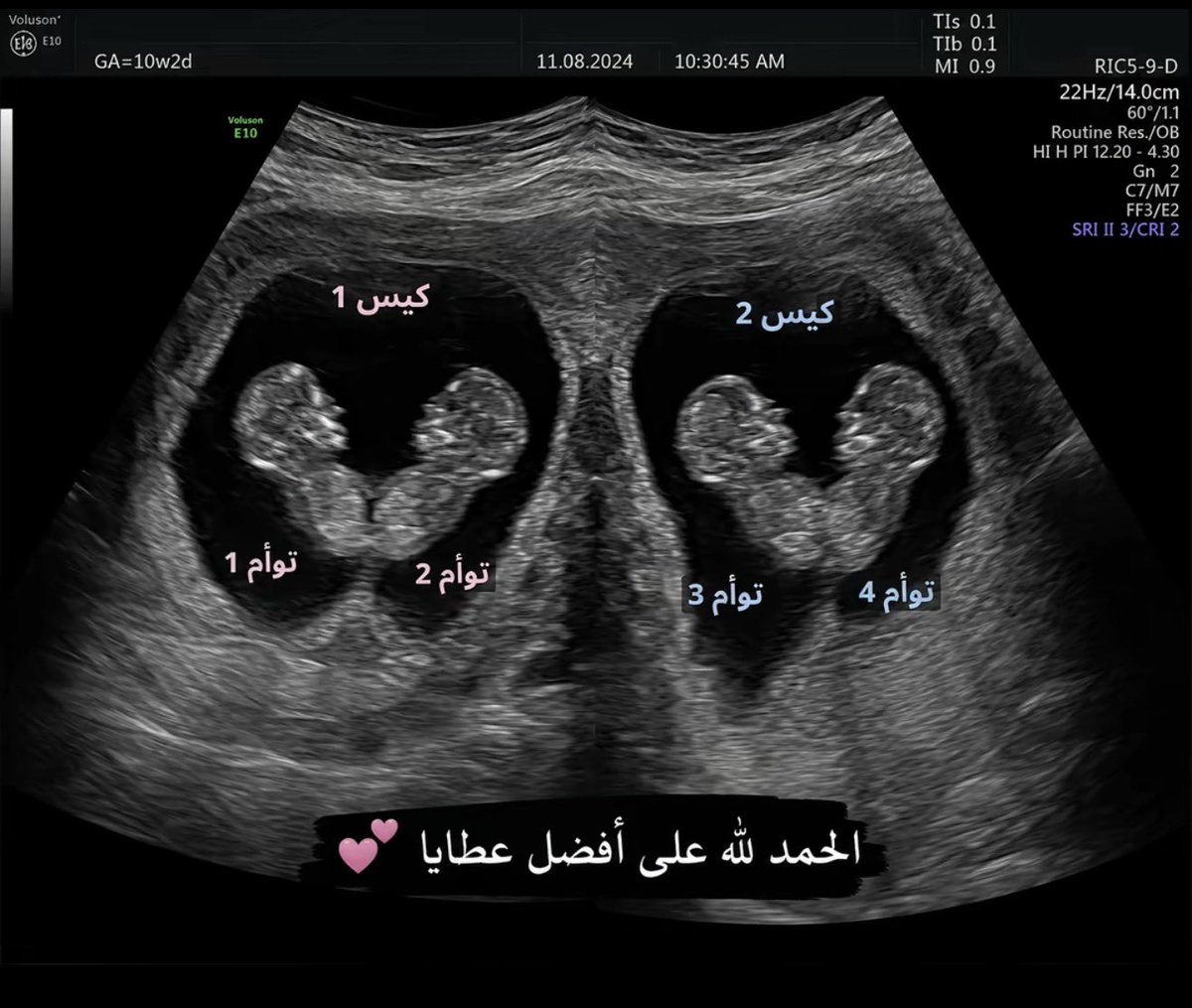 ALHANOOF🇶🇦 tweet media