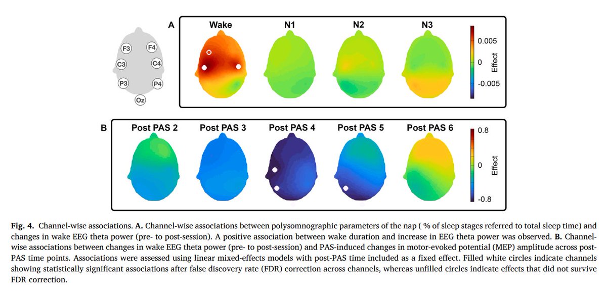 calotonterias's tweet photo. Echar la siesta restaura la plasticidad sináptica en la corteza cerebral al reducir la saturación sináptica acumulada. Esto favorece tanto la capacidad de aprendizaje (codificación de información nueva) como, según estudios previos, la consolidación de la memoria.

Durante la vigilia las sinapsis se fortalecen de forma general en toda la corteza hasta llegar a un estado de saturación. Esto dificulta hacer nuevos cambios específicos en las conexiones. La siesta reduce esa fuerza general de las sinapsis (se observa como menor excitabilidad cortical y menos actividad theta en el EEG de vigilia). Al bajar esa saturación, el cerebro recupera la capacidad de fortalecer de forma selectiva las sinapsis importantes para aprender información nueva o consolidar lo ya aprendido.