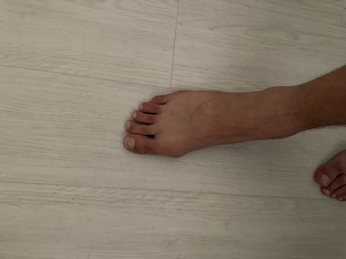 TheCashSimpKing's tweet photo. My feet were made to be worshipped by pathetic cash fags like you. Every dollar you send gets you one second closer to licking them clean.
#findom #lickitclean #payup #simp https://t.co/SI5UbEdoQI