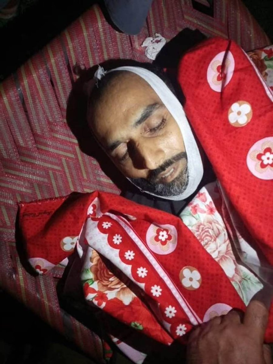 YasserNaveed's tweet photo. اقوامِ متحدہ کی جنرل اسمبلی میں پاکستانی سفارتکار ملیحہ لودھی نے ایک کشمیری بچی کی تصویر لہرا کر دنیا کو بتایا تھا کہ بھارتی فورسز کشمیر میں پیلٹ گنز استعمال کر رہی ہیں۔ پاکستان میں انسانی حقوق کی تنظیموں نے برسوں یہ مؤقف اختیار کیا کہ پیلٹ گنز کا استعمال غیر انسانی ہے، کیونکہ یہ لوگوں کو عمر بھر کے لیے اندھا کر سکتی ہیں۔

آج راولاکوٹ سے آنے والی تصاویر بھی ہمارے ضمیر پر دستک دے رہی ہیں۔ مقامی صحافیوں اور عینی شاہدین کے مطابق مظاہرین پر براہِ راست گولیاں چلائی گئیں۔ اگر انسانی حقوق ایک آفاقی اصول ہیں تو ان کا اطلاق یہاں بھی ہونا چاہیے، نہ کہ صرف سرحد کے اُس پار۔

مجھے افسوس ہے کہ جسے ہم نے برسوں “شہ رگ” کہا، آج اسی کو لہولہان کر دیا-

عاطف توقیر

تصویر میں شہید ہونے والے عثمان نذیر ہیں جو جموں کشمیر جوائنٹ ایکشن کمیٹی کے کور ممبر عُمر نذیر کے بھائی ہیں۔
#RightsMovementAJK