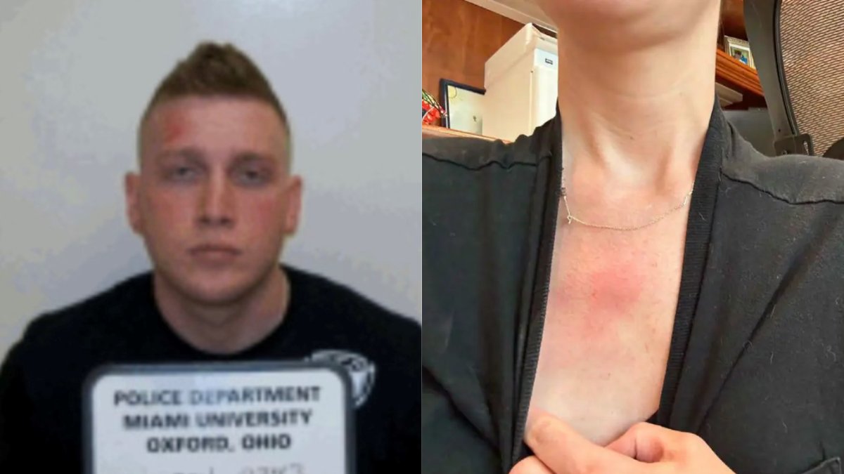 factpostnews's tweet photo. New court filings reveal GOP Rep. Max Miller allegedly poured hot water on his wife, put a gun to her head, and may have broken his 2-year-old daughter's collarbone. https://t.co/iph0Myyz8S