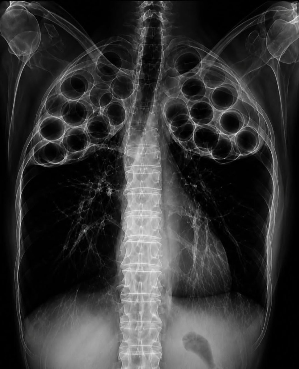 kh505043's tweet photo. Spot diagnosis..?!

. https://t.co/eWapOdgkZ2