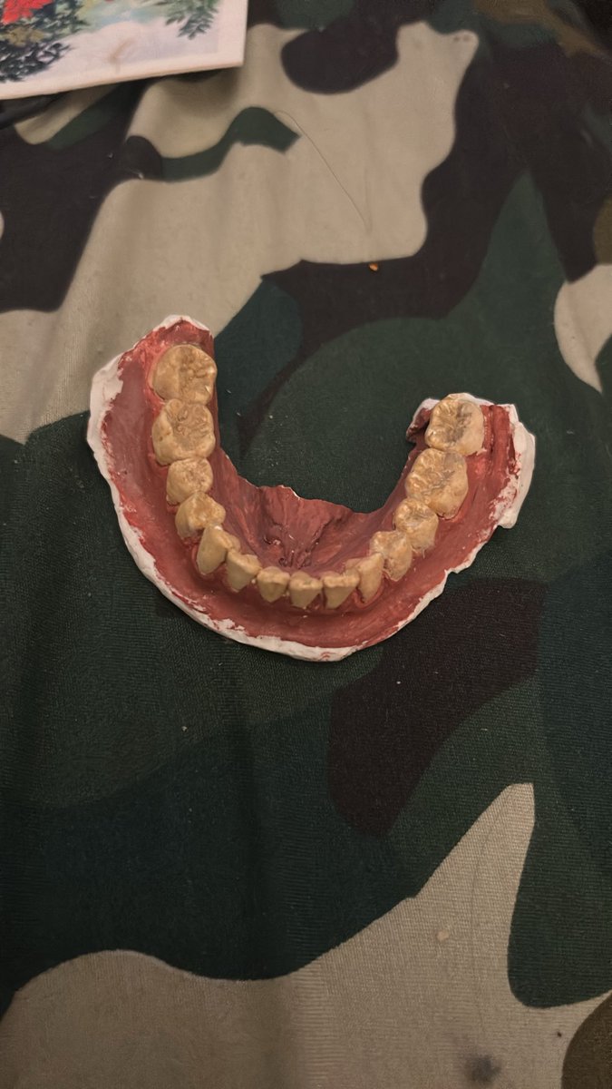 wet_as_'s tweet photo. my bottom teeth https://t.co/q6oijI6u4U