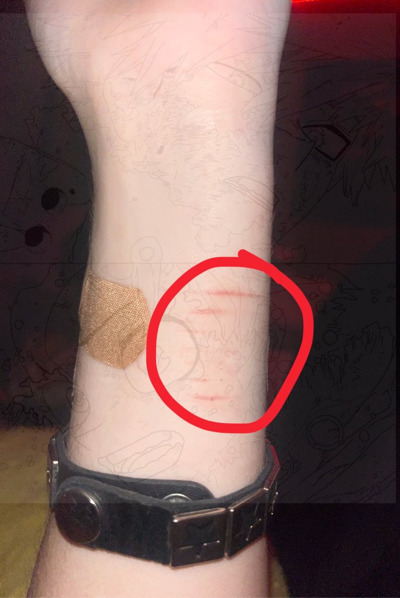 misika_idk's tweet photo. also does anyone know if there’s any nerves around the area of the ones in the 3rd pictures i lowkey think i hit a nerve or something (this is all makeup elon) https://t.co/wd2u3PMXd1