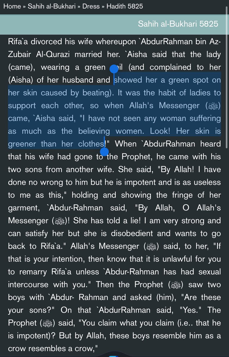 RationalismRule's tweet photo. @david_g17 @MasterMaliq New Hadith for me. This is the one I usually send them. Bruised so bad her bruises are greener than her clothes. 

Mohammad says/does nothing about the severity of the beating. https://t.co/ooYQaVgveE