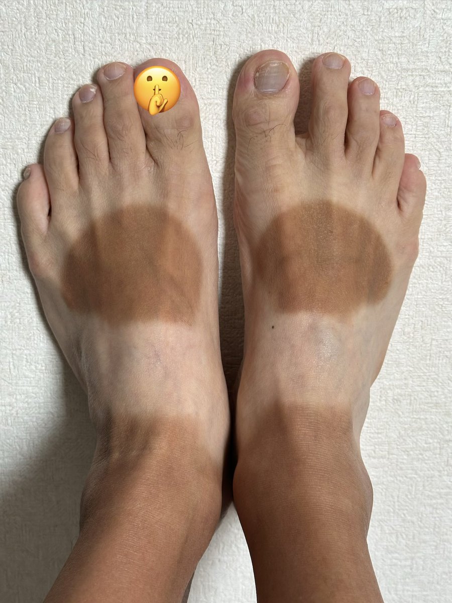 anken1395's tweet photo. #NIKE #足袋シューズ #エアリフト 

夏は🌞特に注意🚨⚠️ 

こうなります😅（日焼け足の画像👇）🦶✨
※キリンの足⁉️🤣💦

でも…確か走りやすい🏃‍♂️💨💦

※因みに靴下履くなら…
 #足袋スニーカー  の開口部無意味😂

※好きですが… #スニーカーマニア ではありません🤭🤙✨ https://t.co/wR6gWHuc8M