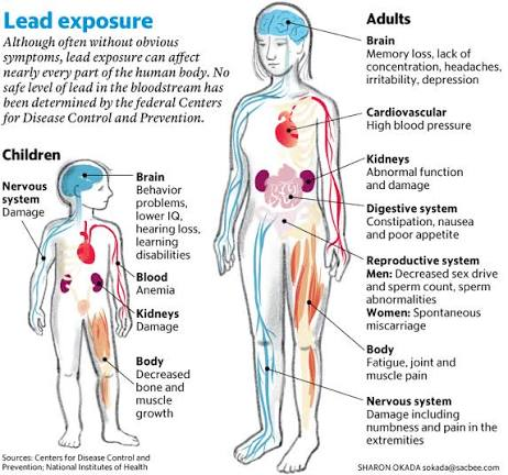 Jim_Kuback's tweet photo. @liquidtrain Just simplify it by doing mandatory testing for lead poisoning, since anyone with over a certain amount of lead in their system shouldn't be trusted in government positions with the way lead gives you mental disabilities. Specifically issues with having normal human empathy. https://t.co/uYasyunvF6