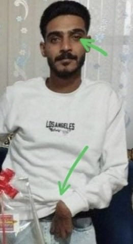 pink4iran's tweet photo. 💔 They executed AmirHossein Safari.

Look at this photo.

His eye.
His hand.
Half of his body could not move.

The Islamic regime tortured a disabled young man, sentenced him for a crime he did not commit, and killed him anyway.
Remember his name 🥀😔
AmirHossein Safari
#اميرحسين_صفرى
