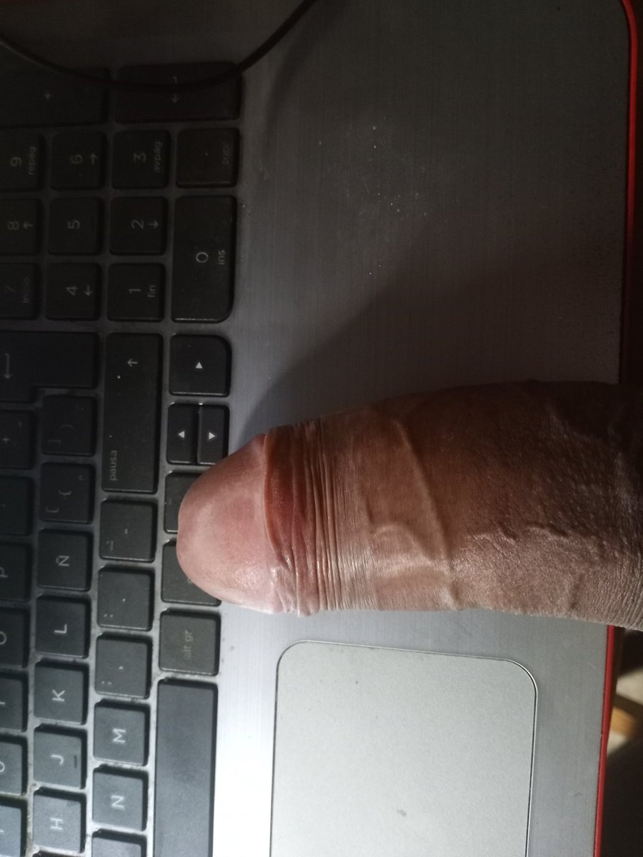 Didierrst's tweet photo. https://t.co/cH3hiLfzZ8
