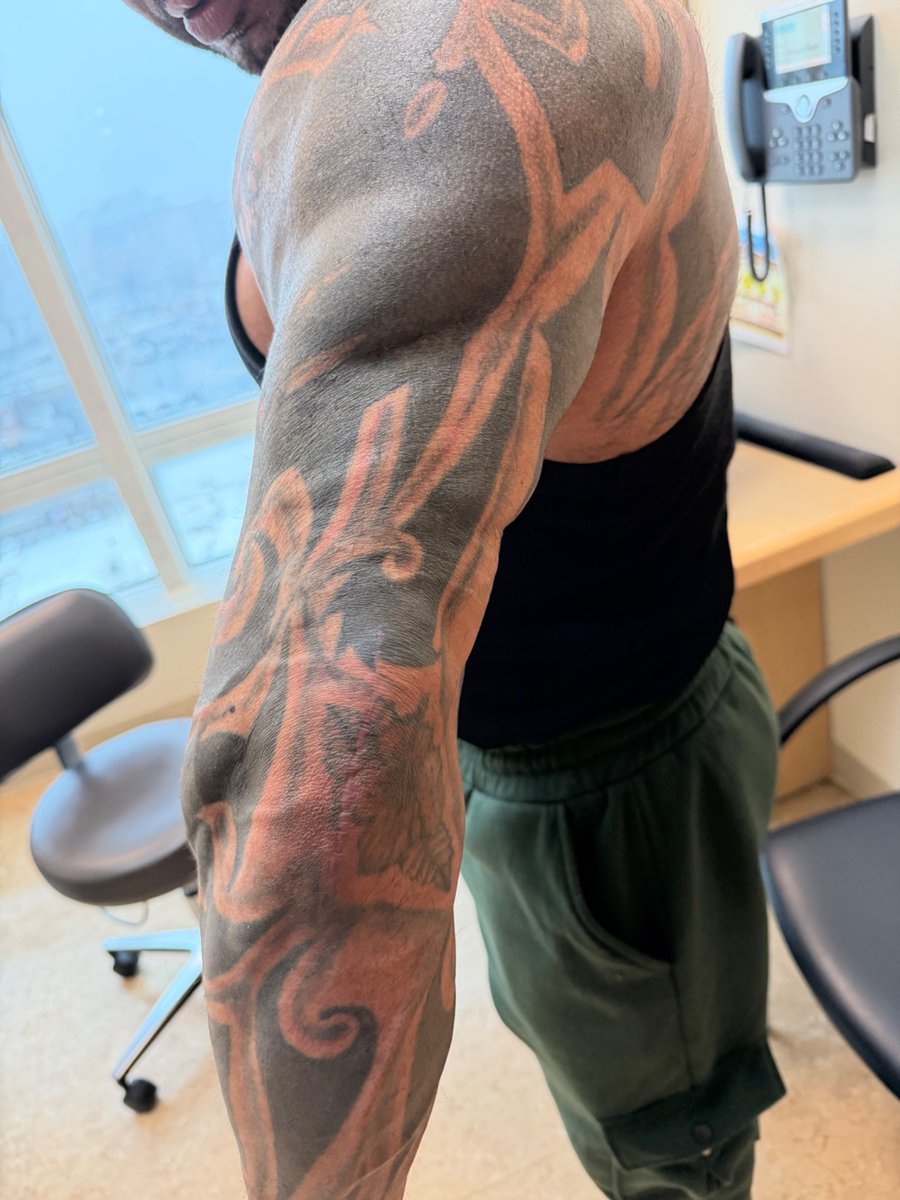MontefioreOrtho's tweet photo. From a full triceps repair in December to earning an IFBB Pro Card in July! 🏆 

Massive congrats to Carlos Lopez on winning the Men’s Physique Masters 50+ title at the NPC Universe. Proof that with elite rehab and serious grit, the comeback is always stronger than the setback! https://t.co/yPlnmiUhAM