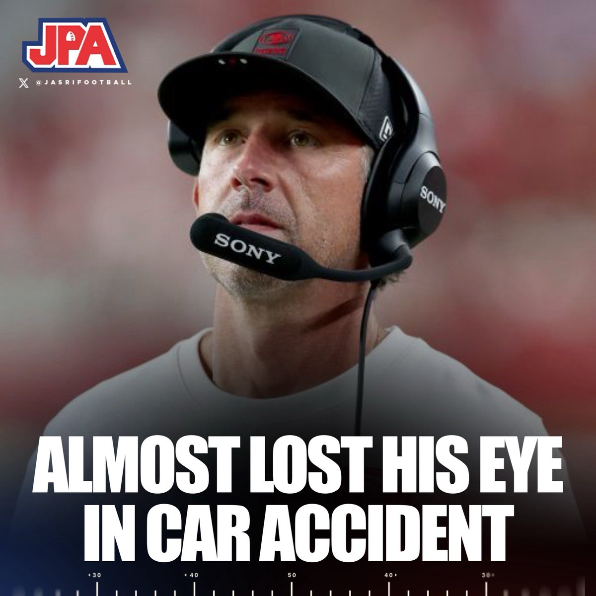 jasrifootball's tweet photo. 𝗥𝗘𝗣𝗢𝗥𝗧: 49ers’ HC Kyle Shanahan nearly lost his eye from the car accident he was involved in a few weeks ago, according to Chris Simms.

The accident has reportedly left Shanahan extremely shaken, with him realizing that he came close to losing his life. 

“He was this close to maybe losing his right eye, right? The scar is so big right here. And so all that stuff was just crazy to see.”