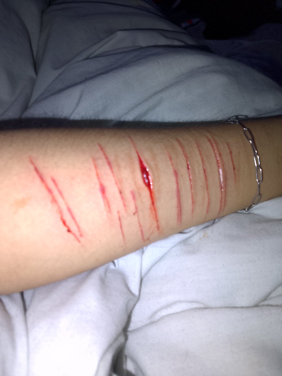 PAras1t1C_W0rmz's tweet photo. #fake #fxs #shtwt #sh #fyp #fypシ゚ https://t.co/izkxUSjIQj