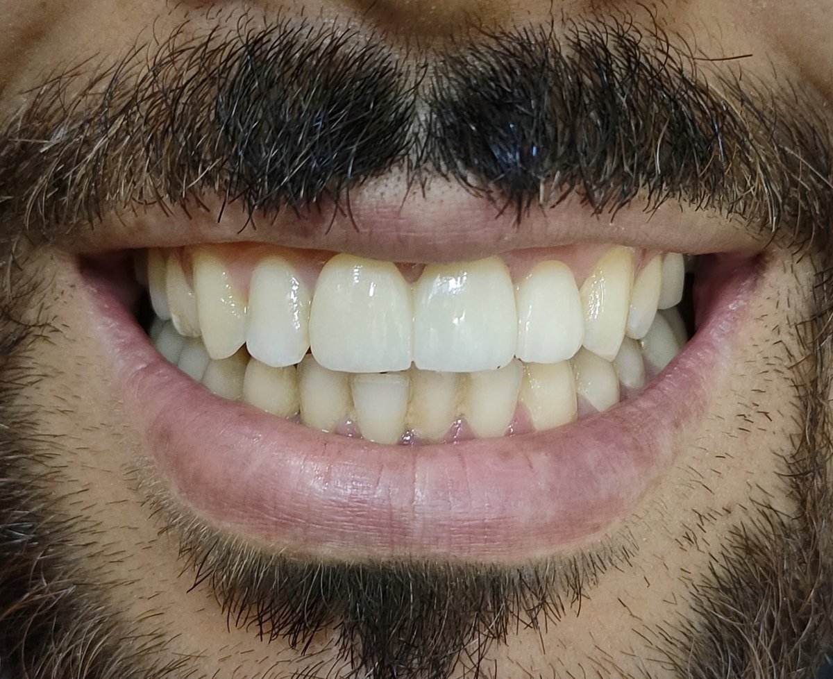 ZiadRida2's tweet photo. Take a breath, your smile is back 🫧🤍 https://t.co/iCGzP1SBls