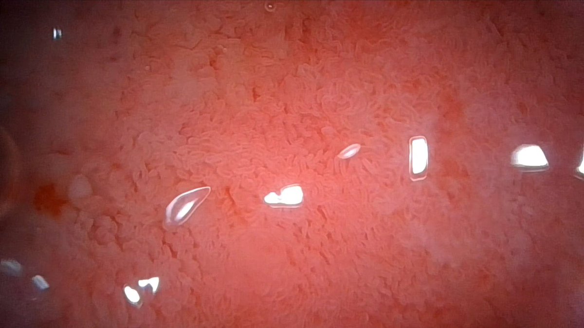 HydraXlame's tweet photo. #endoscope #duodenum #intestine #HD https://t.co/fZ9Si7i6Ld
