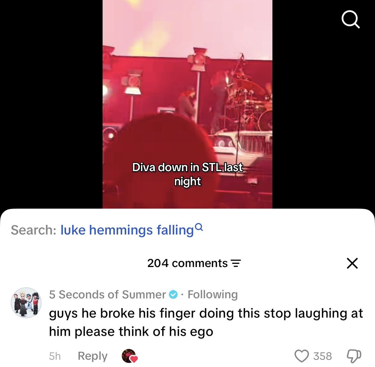 CALMDAlLY's tweet photo. According to 5SOS’ TikTok comment, Luke broke his finger at the St Louis show the other day! 

#EASTour #LukesFingersaStar https://t.co/zSBblVZJSD