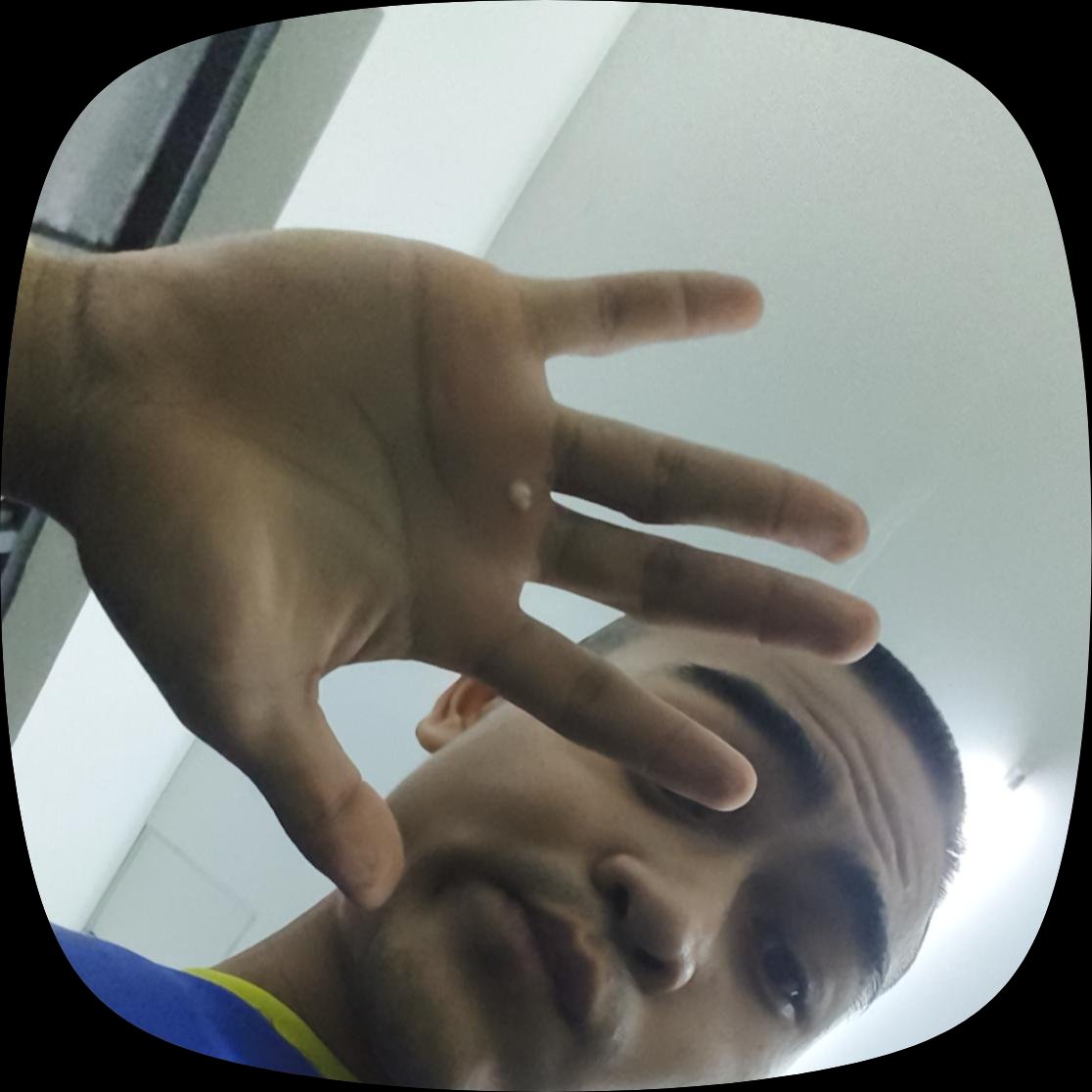 brago109's tweet photo. ทำงานจนมือแตกมีอยู่จริง https://t.co/imzB104mkv