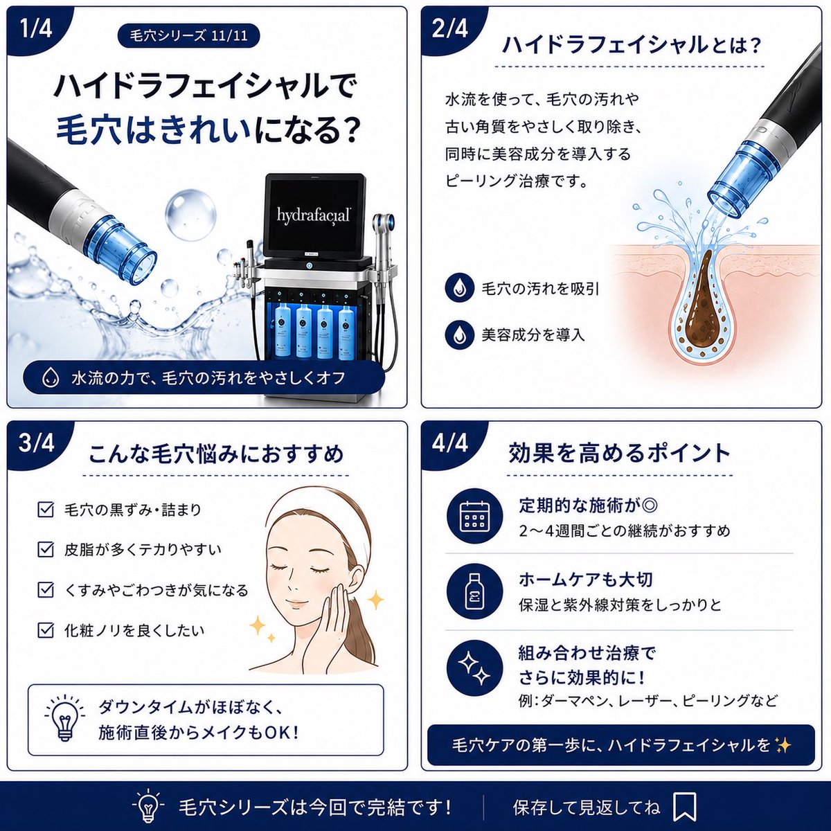 dr_manami's tweet photo. 毛穴シリーズ最後は「ハイドラフェイシャル」。

毛穴汚れや角栓をやさしく除去し、肌をなめらかに整える人気の治療です✨
ただし、毛穴そのものを小さくする治療ではありません。

11回にわたる毛穴シリーズ、ご覧いただきあり���とうございました😊
保存して、治療選びの参考にしてください。 https://t.co/ifIjX3dNQz