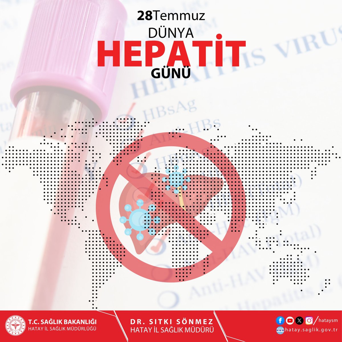hataysm's tweet photo. 28 Temmuz Dünya Hepatit Günü

Hepatit; karaciğeri etkileyen, erken tanı, aşılama ve doğru tedavi ile büyük ölçüde önlenebilen ve kontrol altına alınabilen önemli bir halk sağlığı sorunudur.

28 Temmuz Dünya Hepatit Günü vesilesiyle; hepatit konusunda farkındalığın artırılması, risk gruplarının taranması, güvenli yaşam alışkanlıklarının benimsenmesi ve aşı ile korunmanın önemini bir kez daha hatırlatıyoruz. Düzenli sağlık kontrolleri ve erken tanı, karaciğer sağlığının korunmasında hayati önem taşımaktadır.

Sağlıklı bir gelecek için hepatite karşı bilinçlenelim, korunma yöntemlerini uygulayalım ve gerekli durumlarda sağlık kuruluşlarına başvuralım.

Erken tanı hayat kurtarır, aşı ile korunmak mümkündür.

#28Temmuz #DünyaHepatitGünü #Hepatit #ÜretenSağlık